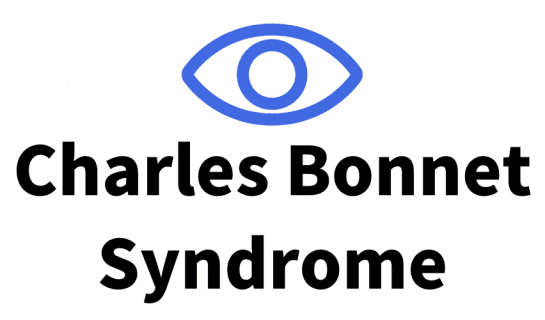 On icon of an eye in royal blue and the text 'Charles Bonnet Syndrome'
