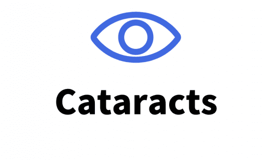 Cataracts